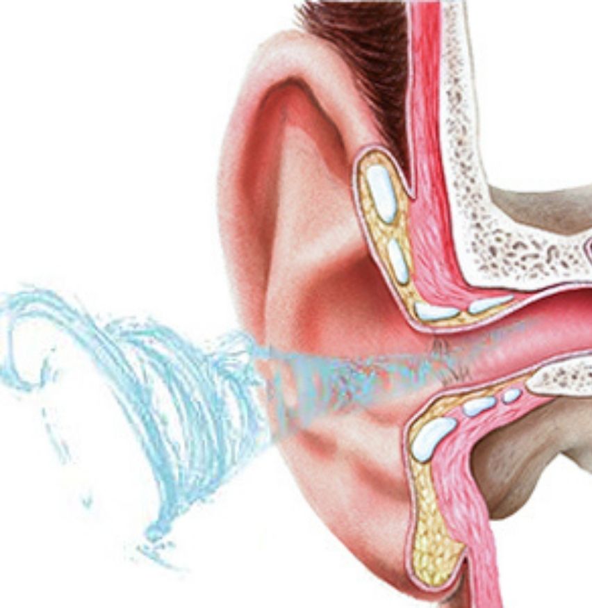 Ear Washer: image 7