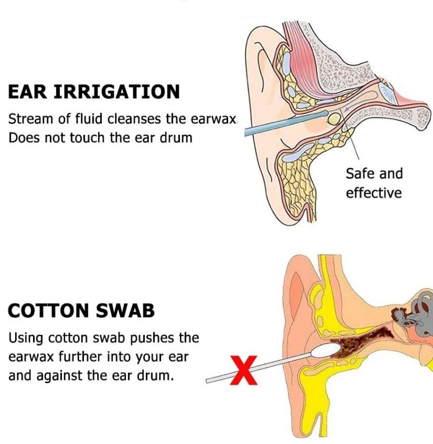 Ear Washer: image 8