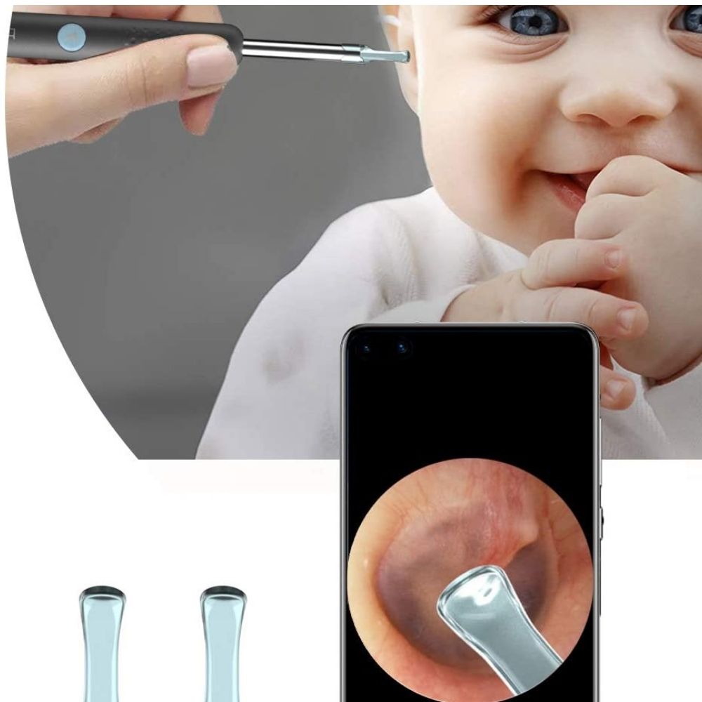 Video Otoscope Ear Cleaner: image 5